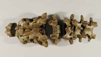 lower vertebrae