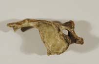 second cervical vertebra