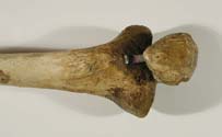 shin bone and knee cap