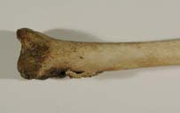 tibia