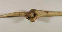 arm bones