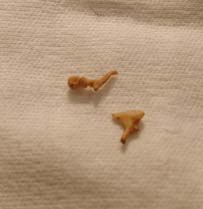 Rev. John Southmayd's Ear Bones