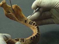Dental Examination